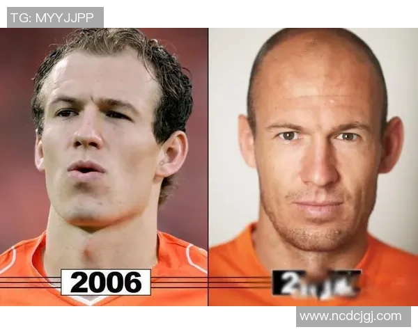 9位足球明星罕见秃头造型大集锦,勇敢面对发量挑战的球场英雄 9位足球明星罕见秃头造型大集锦,勇敢面对发量挑战的球场英雄